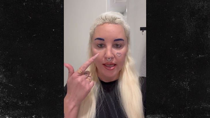 Amanda Bynes rivela di essersi sottoposta a un intervento di chirurgia plastica sulle palpebre
