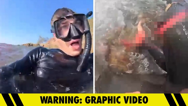 Un uomo filma le conseguenze dell'attacco di uno squalo che gli ha costato una gamba in Australia
